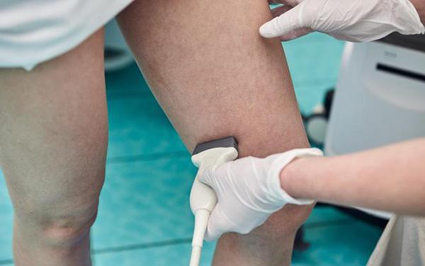 Źle leczone zakrzepowe zapalenie żył powierzchownych może być groźne